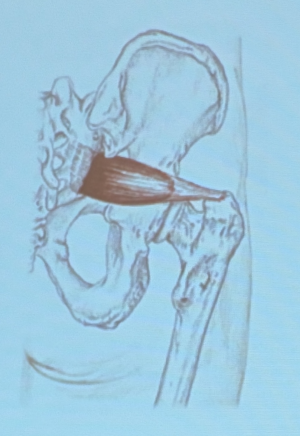 <p>Muscle name?</p>