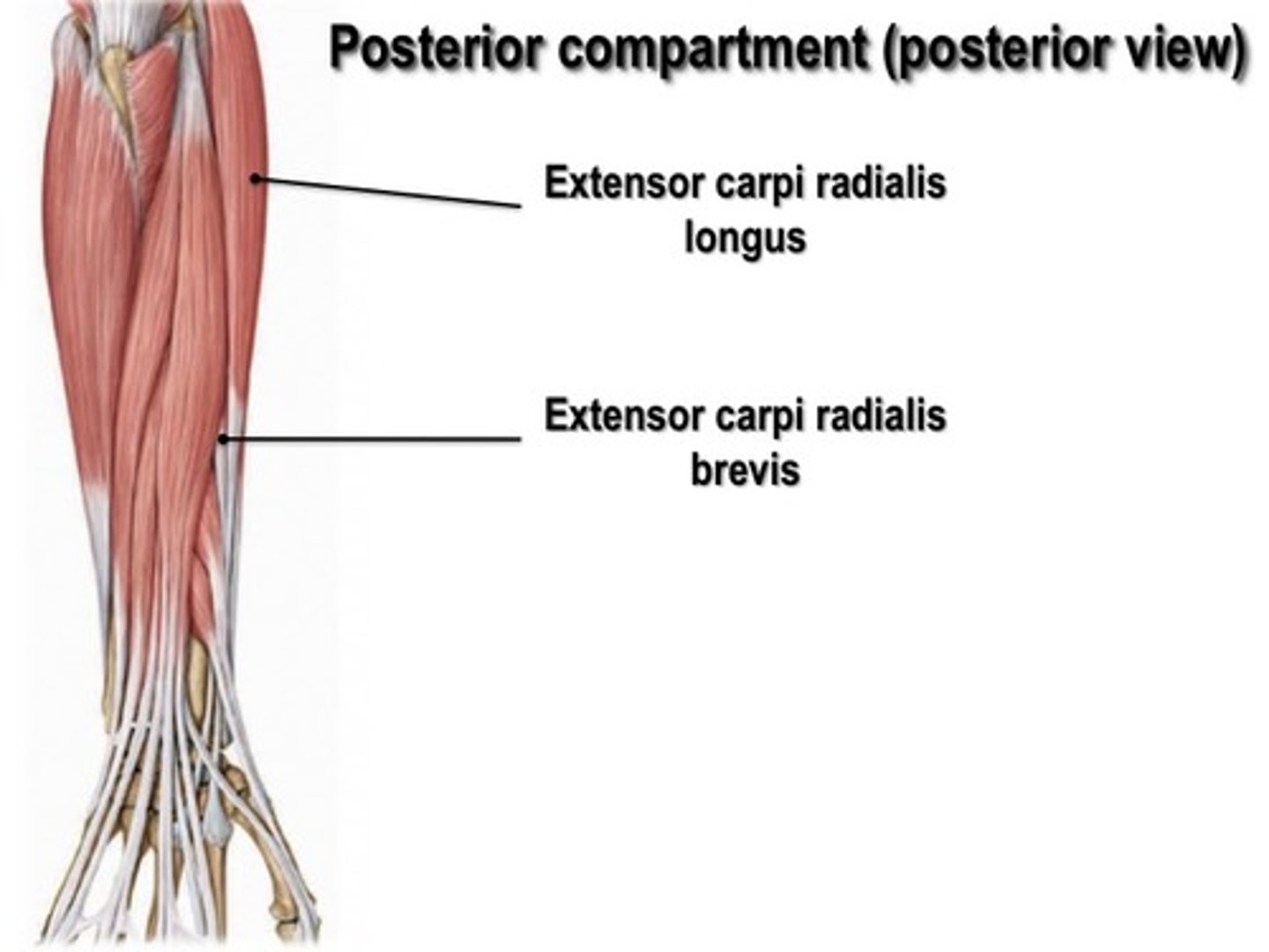 <p>Extensor Carpi Radialis (Longus &amp; Brevis)</p>