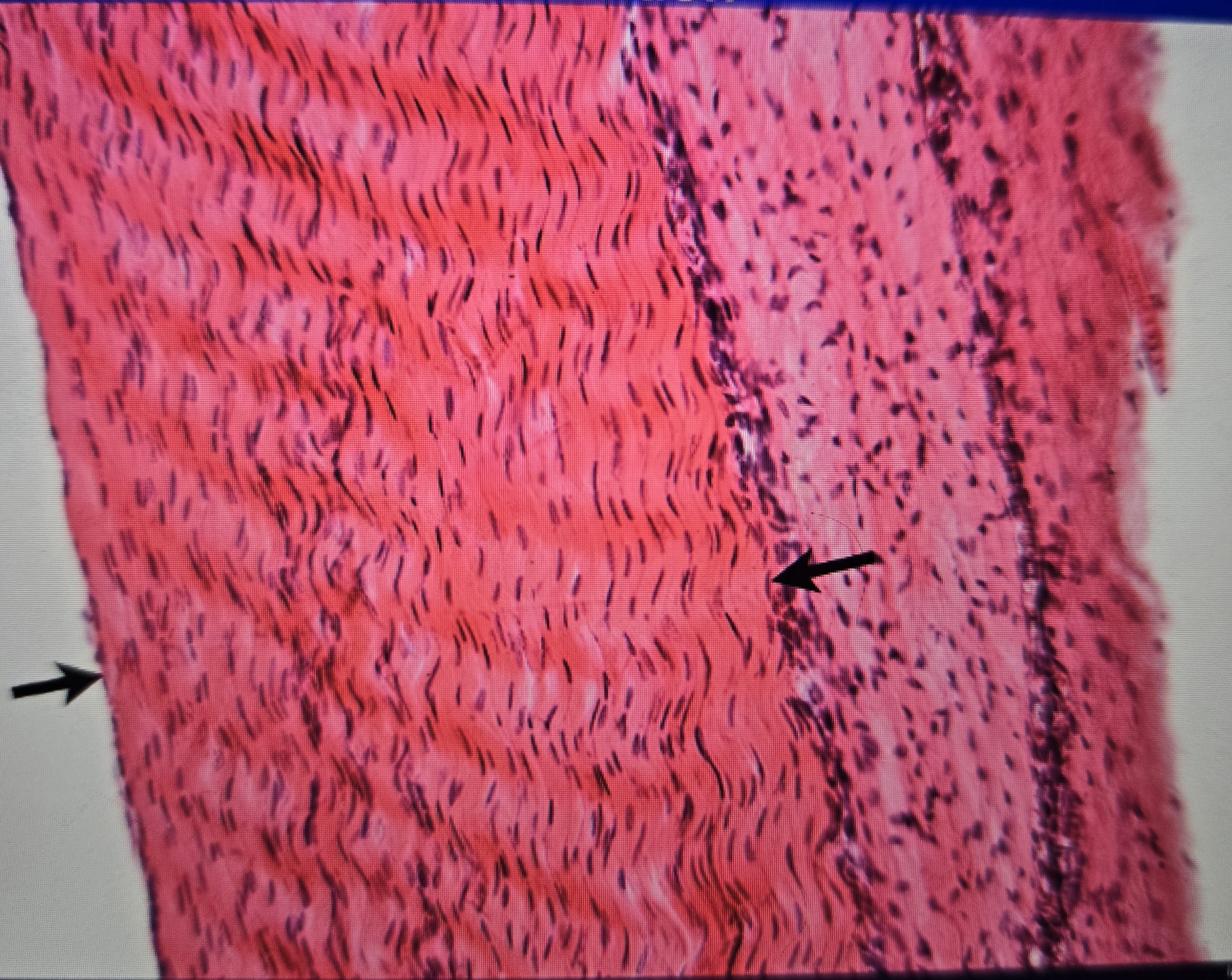 term image
