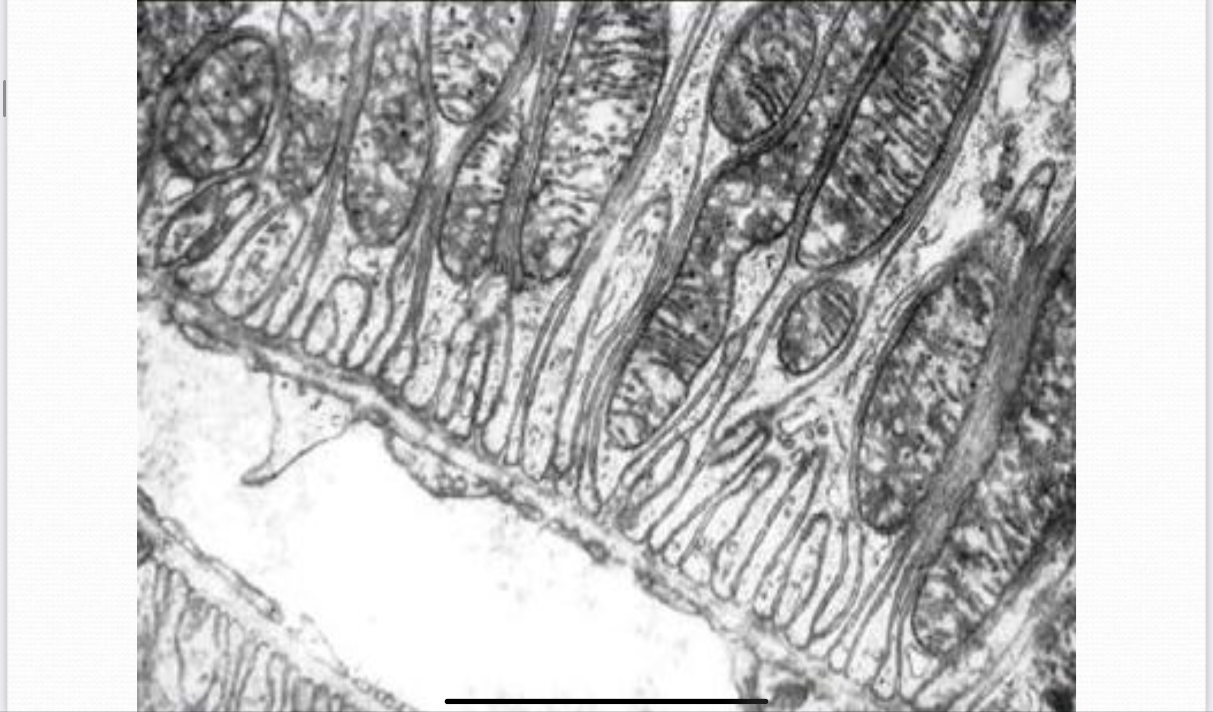 <p>Desmosome (macula adheren)</p>