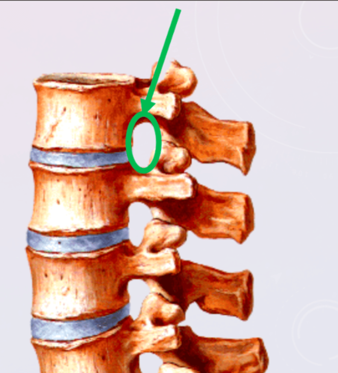 <p>- Only found with two vertebrae connected</p><p>- Runs transversely</p><p>- The portion of the spine that is inflamed during stenosis of the cervical/lumbar region(s)</p>