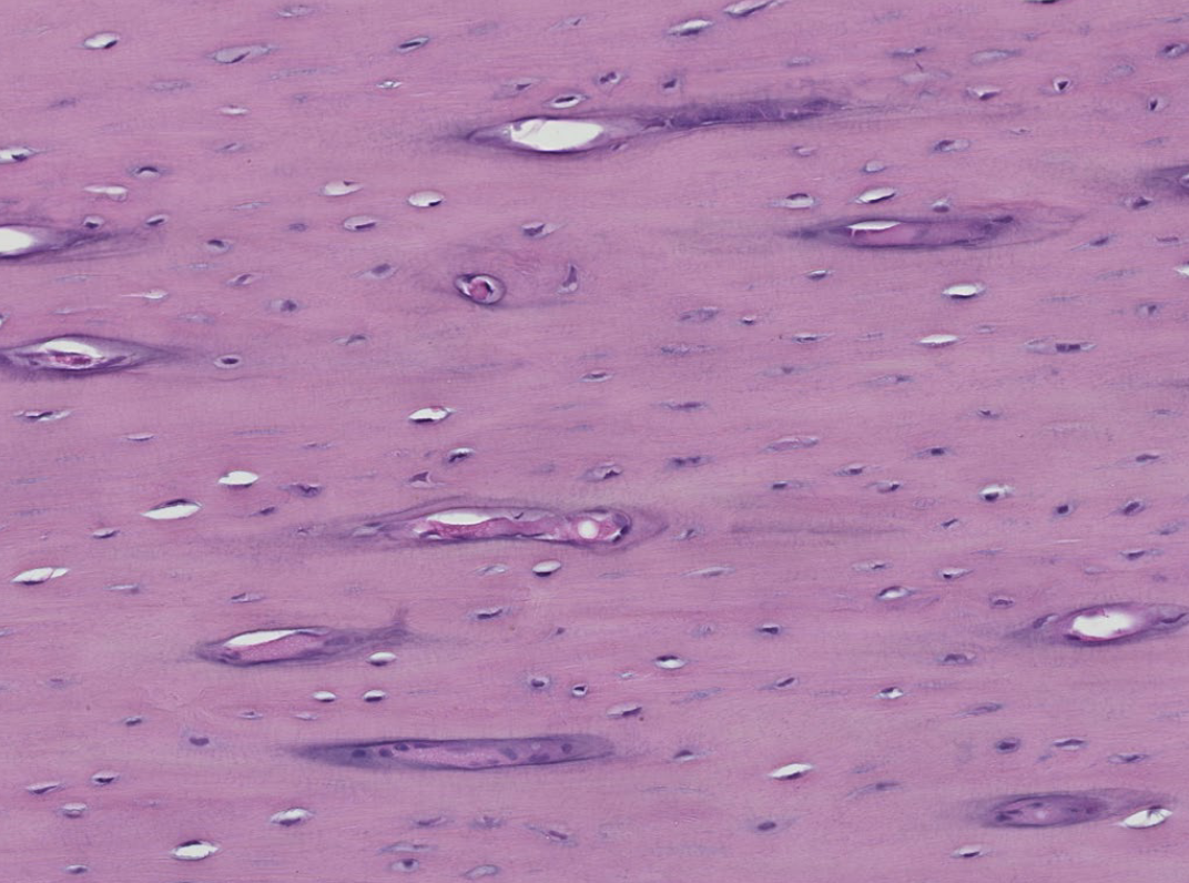 <p>ID the bone type shown in this H&E stain (longitudinal tissue section)</p>