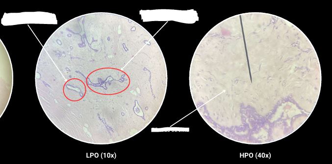 <p>What are the arrows pointing?</p>