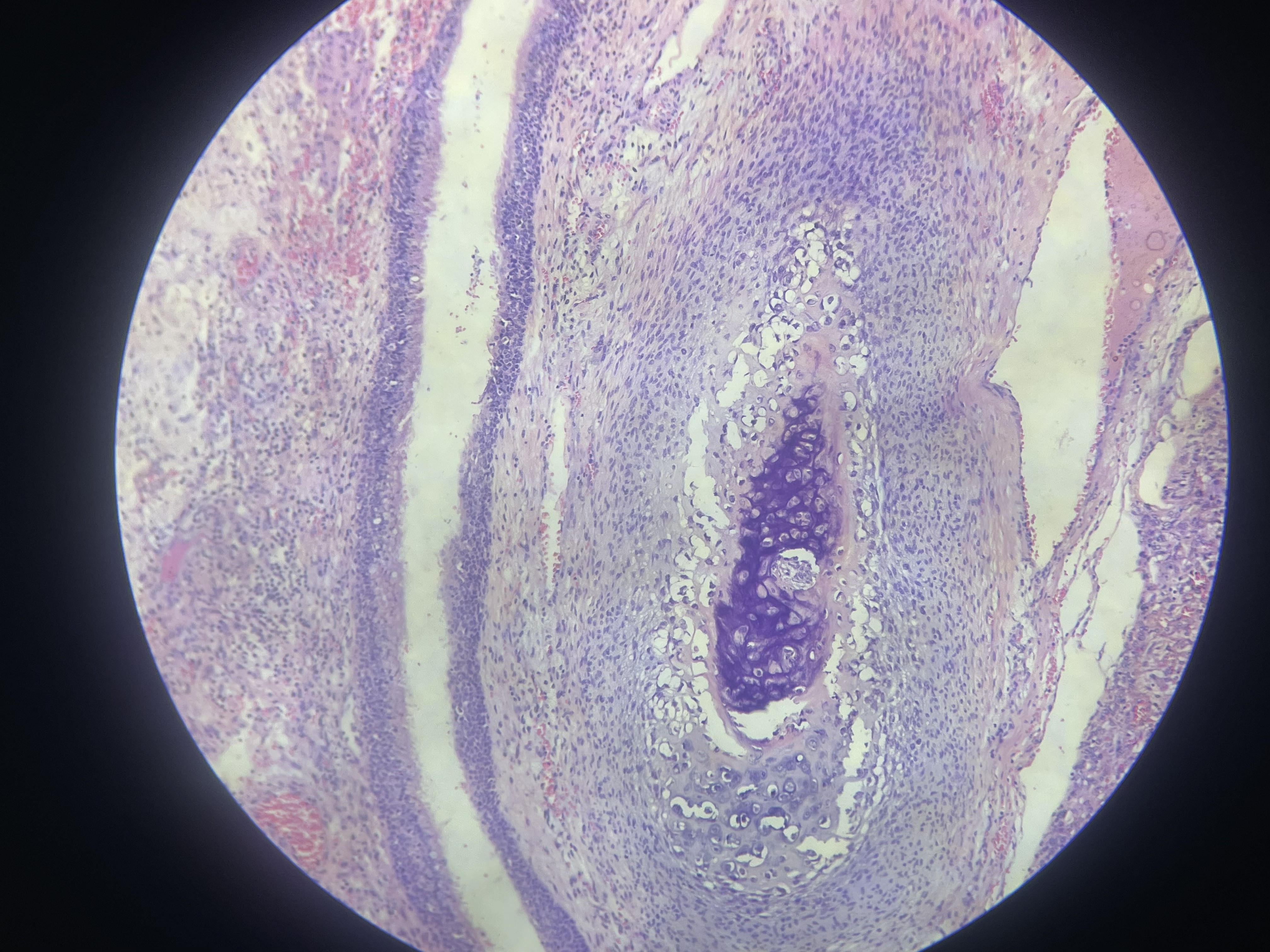 <p>What is the diagnosis?</p>