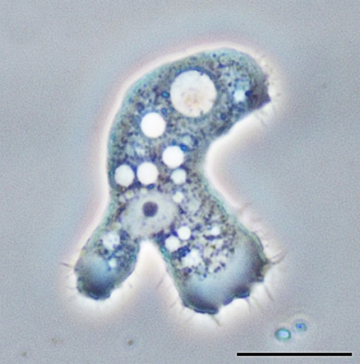 <p><span style="color: rgb(0, 0, 0);"><strong><em><mark data-color="#d34141" style="background-color: rgb(211, 65, 65); color: inherit;">Acanthamoeba </mark></em></strong></span></p>