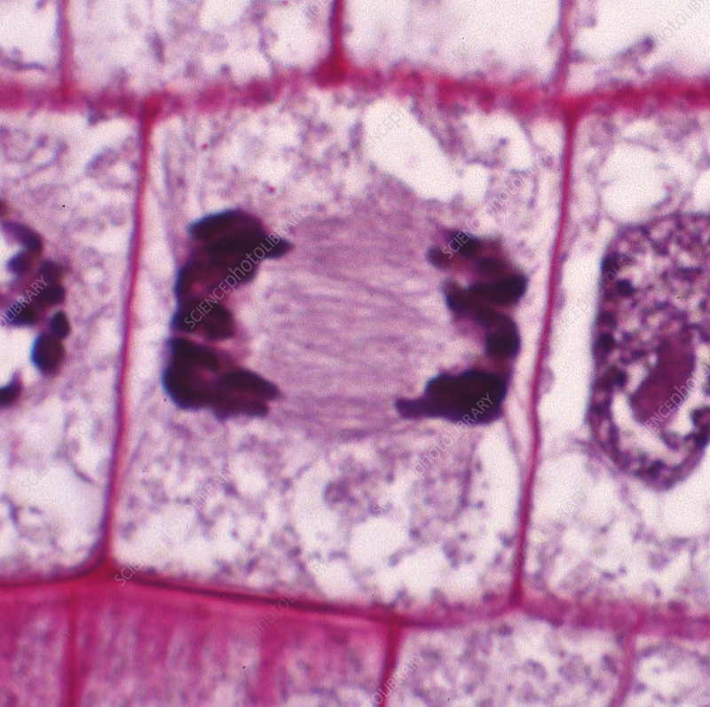 <p>chromosomes are at the opposite ends and new nuclei are are forming on each side to make new cells</p>
