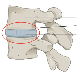 <p>What is this joint?</p>