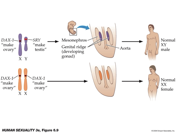 <ul><li><p><strong>Chromosomes:</strong></p><ul><li><p><strong>XY (male):</strong> Presence of <strong>SRY gene (Y chromosome)</strong> → dominant → testes develop.</p></li><li><p><strong>XX (female):</strong> No SRY; <strong>DAX-1 (X chromosome)</strong> promotes ovary development.</p></li></ul></li><li><p><strong>Common origin:</strong></p><ul><li><p>Both testes and ovaries develop from the <strong>genital ridge</strong> (with tissue contribution from mesonephros).</p></li></ul></li><li><p><strong>Cell differentiation:</strong></p><ul><li><p><strong>With SRY:</strong> → <strong>Sertoli cells</strong> form → gonads develop into <strong>testes</strong>.</p></li><li><p><strong>Without SRY:</strong> → <strong>Granulosa cells</strong> form → gonads develop into <strong>ovaries</strong>.</p></li></ul></li><li><p><strong>Key idea:</strong></p><ul><li><p>Gonadal development depends on <strong>SRY presence vs absence</strong>; hormones and cell signaling then drive male vs female pathways.</p></li></ul></li></ul><p></p>