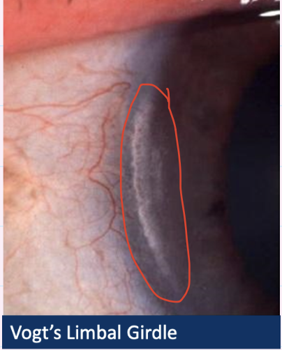 <p>Describe and give diagnosis</p>