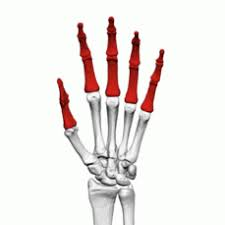 <p>What bone is this?</p>