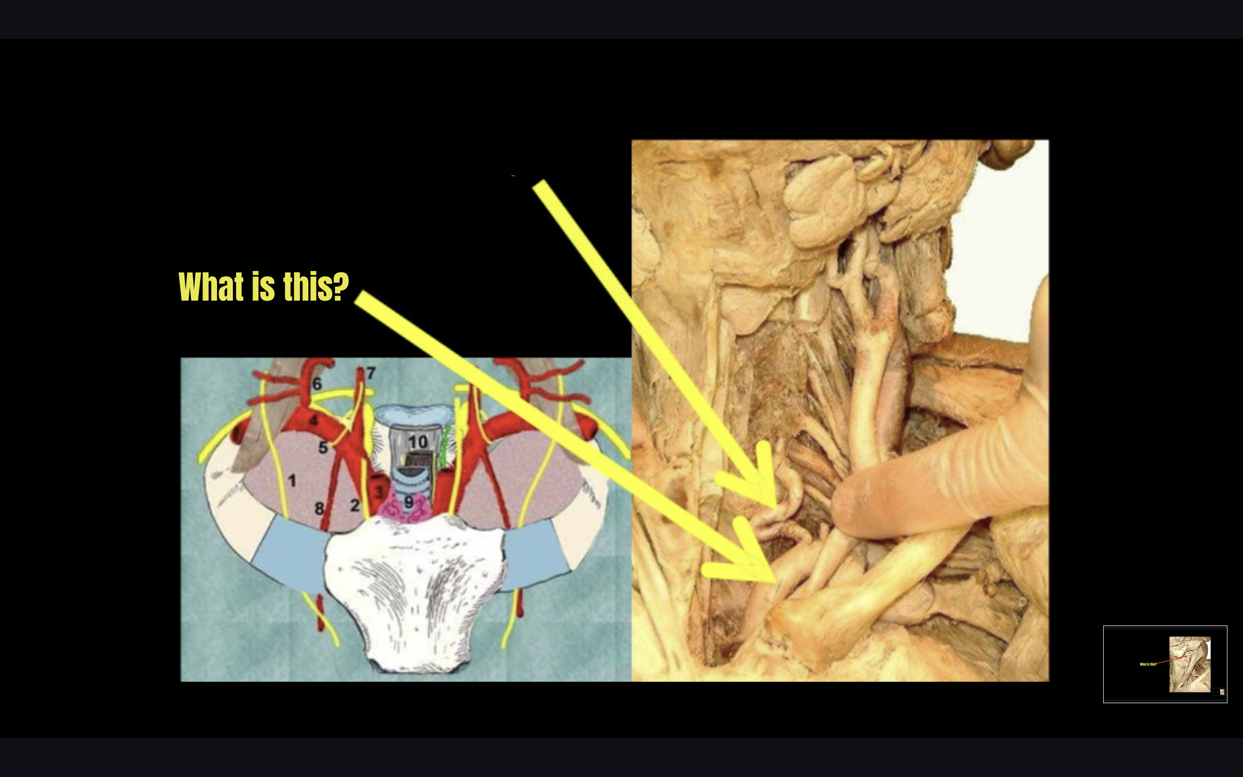 term image