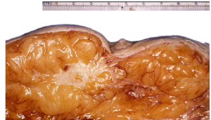 <p>What pathology?</p>