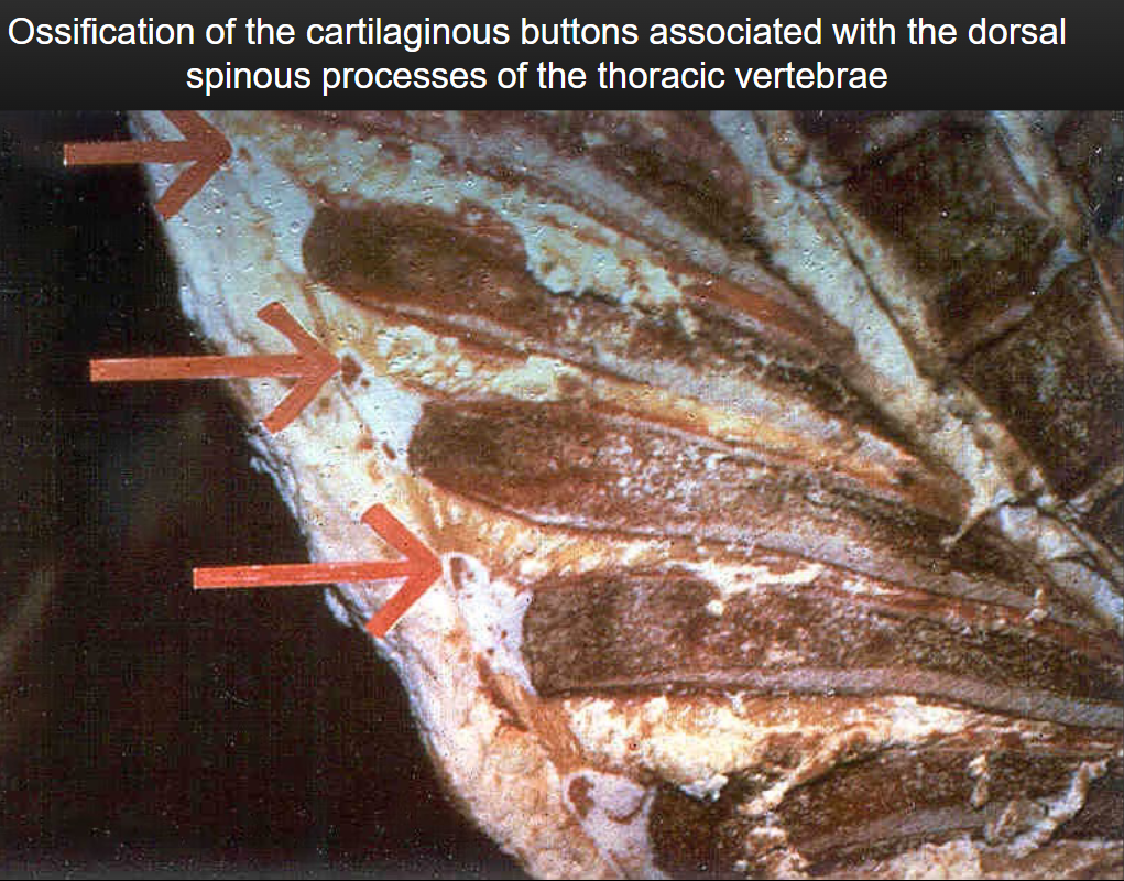<ul><li><p>Dentition; teeth</p></li><li><p>Ossification of the cartliaginous buttons</p></li><li><p>Ribs</p><ul><li><p>Older animals: whiter, wider, flatter</p></li><li><p>Younger animals: red, round, porous</p></li></ul></li></ul><p></p>