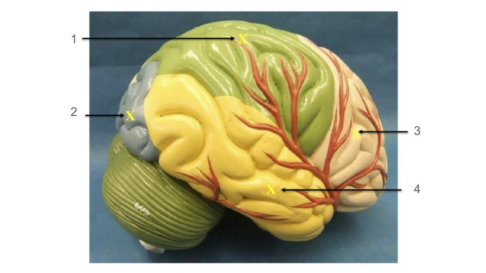 <p>2, lobe</p>