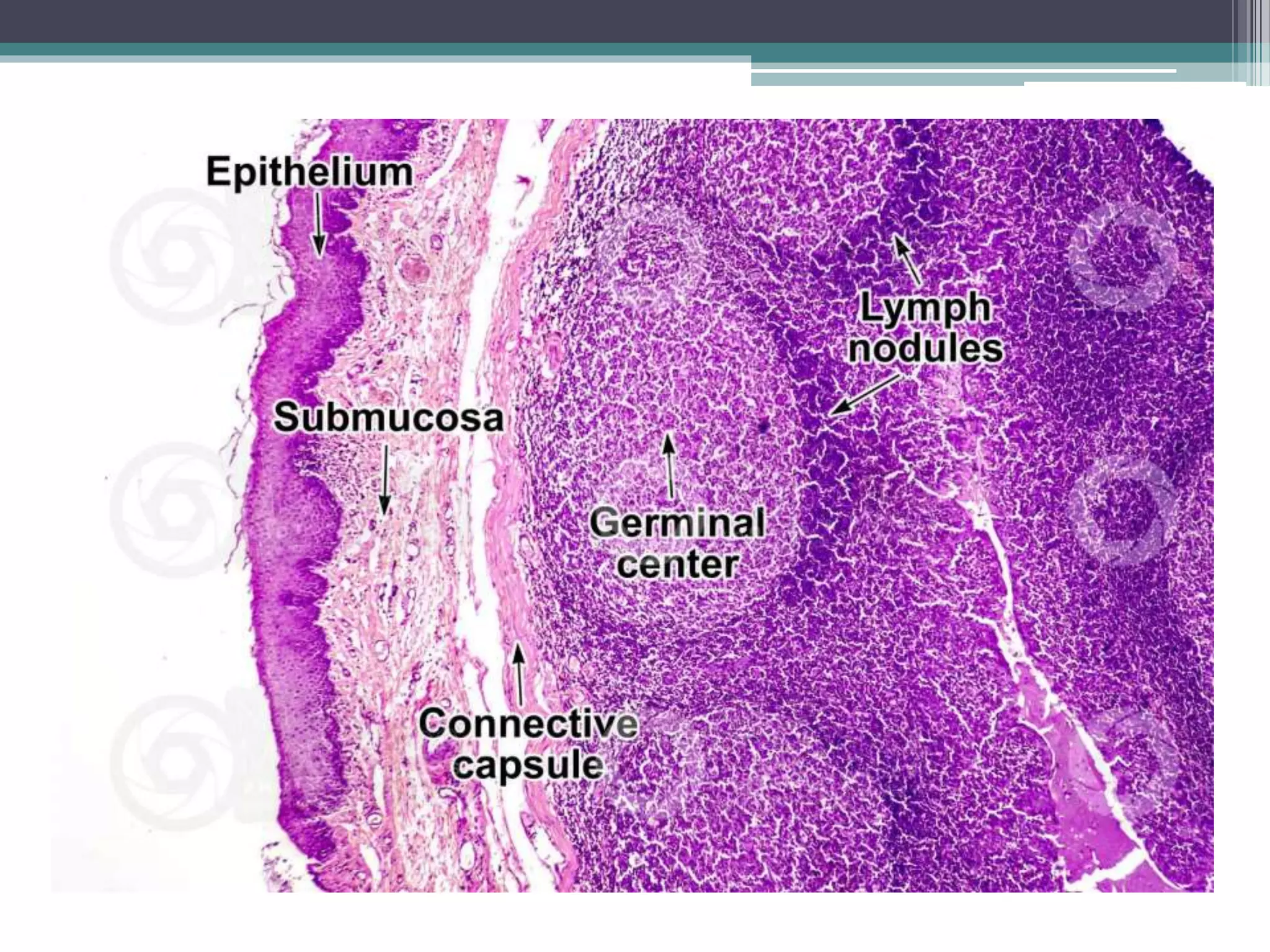 <p>tonsil</p>