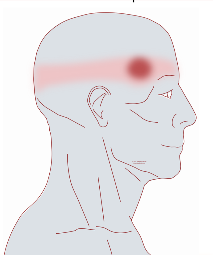 <p>The flat area on each side of the forehead.</p>