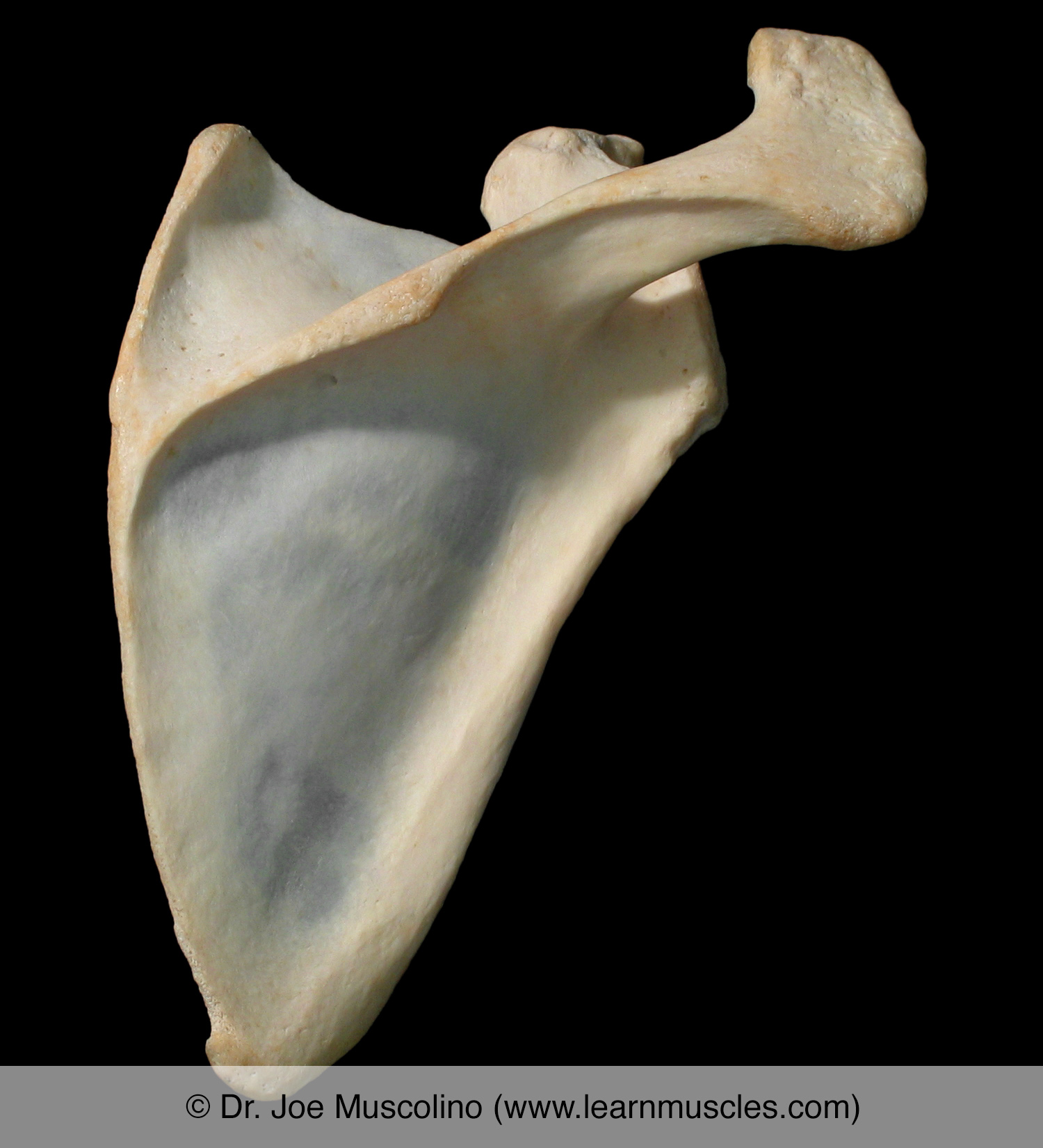 <p>What detached bone is this?</p>