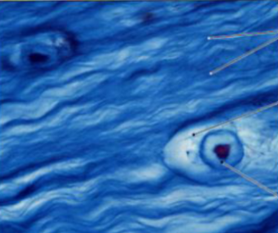 <p><span style="background-color: transparent;">Supporting Connective Tissue: Is this Fibrocartilage, </span>Hyaline Cartilage, or <span style="background-color: transparent;">Elastic Cartilage?</span></p><ul><li><p>Location:</p></li><li><p>Attributes: </p></li></ul><p></p>