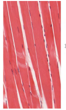 <p>long cylindrical, striated</p><p>many nuclei</p><p>voluntary</p><p>attached to many bones</p>