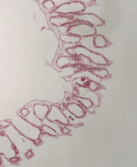 <p>sycon cross section</p>