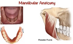 <p>masseter muscle</p>