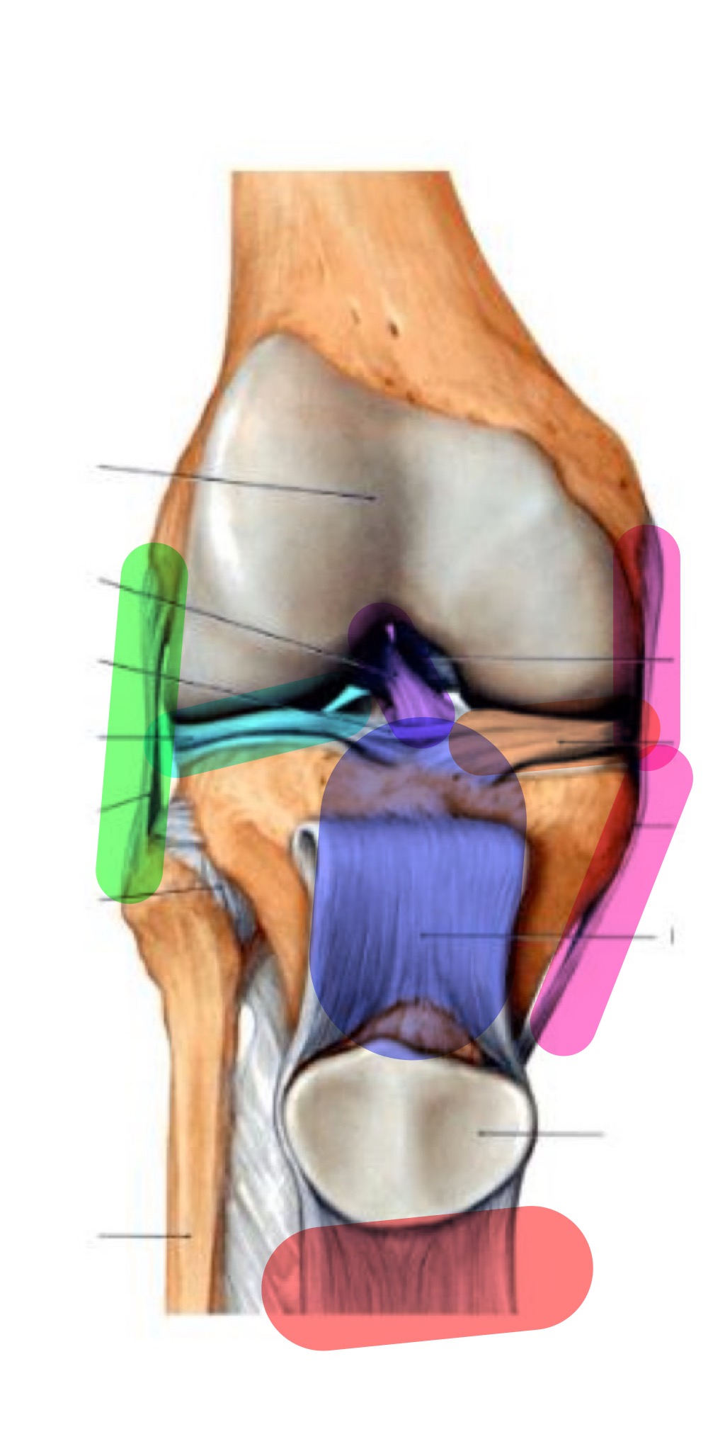 <p>name the ligament that’s highlighted pink</p>