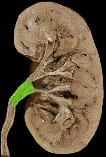 <p>renal pelvis</p>