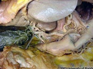 <p>what artery is being indicated to in the image?</p>