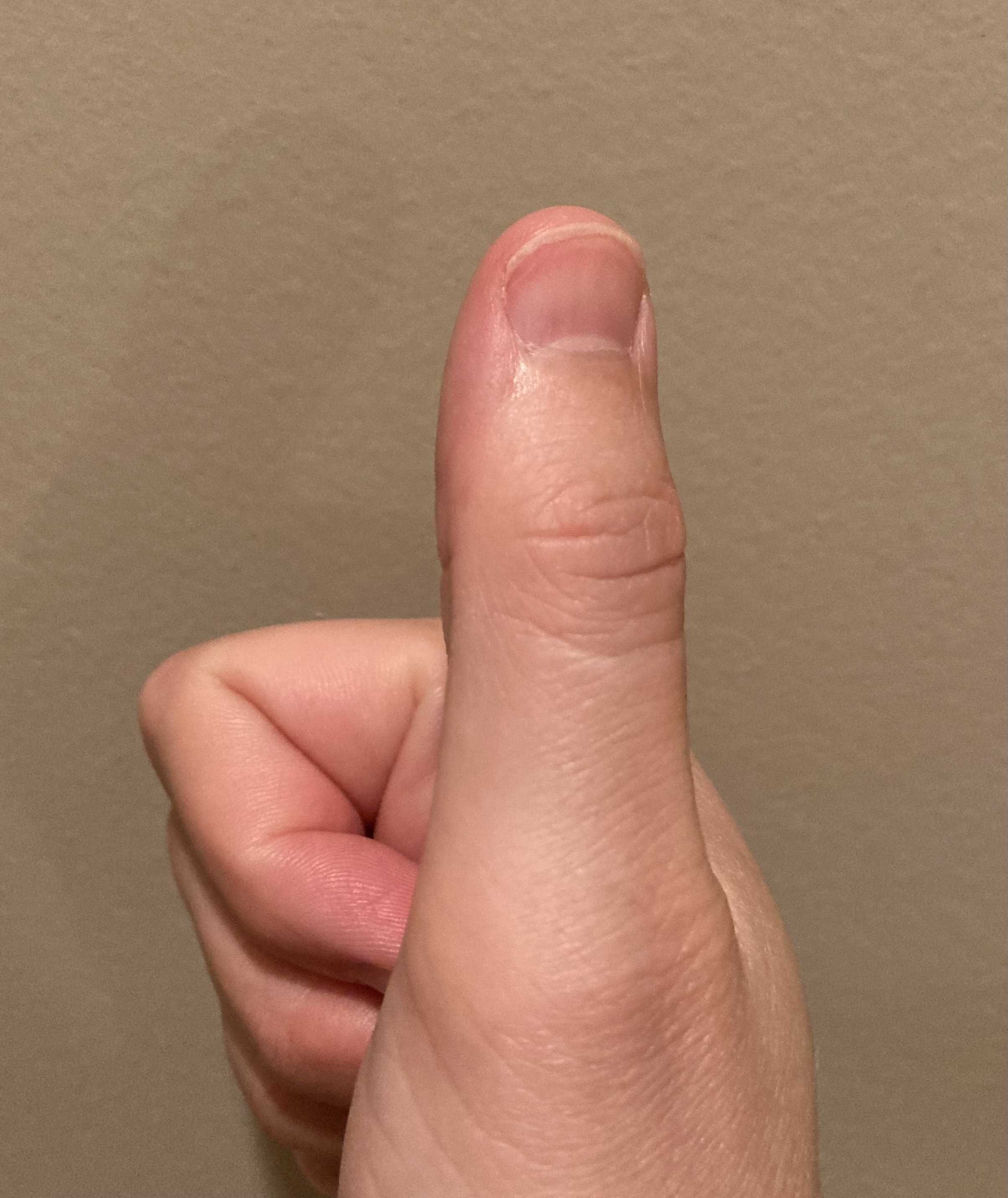 <p>thumb</p>