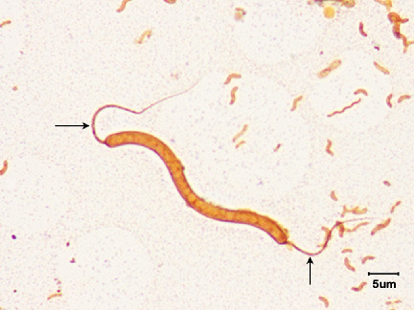 <p>flagella at both ends of the cell</p>