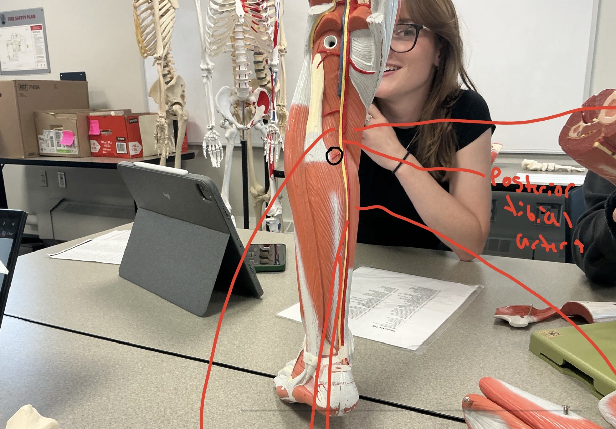 <p>What artery is this?</p>