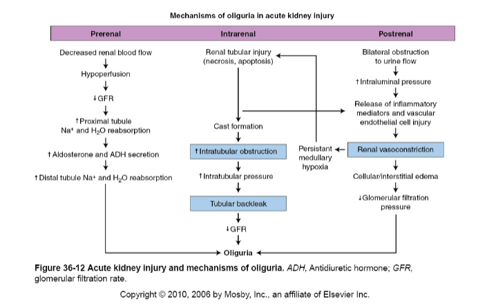 <p>Prerenal vs intralrenal vs postrenal acute failure</p>