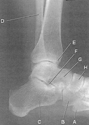 <p>E</p>