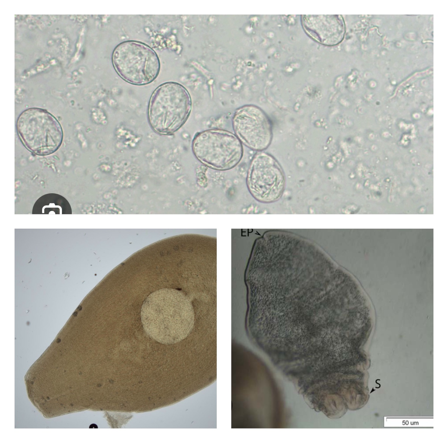 <p>Found in the small intestine of carnivors </p><p>This is the ONLY tapeworm that uses <u>2 intermediates hosts</u> </p><p></p><p>1st intermediate host: <span><span>oribatid </span></span>mite that ingest the proglottids which will then develop into the cysticercoid</p><p>2nd intermediate host: <span><span>rodents, birds, reptiles, or amphibians that ingest the mite then the cysticercoid inside develops into the Tetrathyridium (larval tapeworm)</span></span></p><p>Definitive Host: Canids (Dogs, foxes, coyotes) </p><p><span><em><span>the tetrathyridial larvae multiply exponentially</span></em><span> - huge numbers are of larvae are infective to the dogs and cats which are the definitive hosts. </span></span></p>