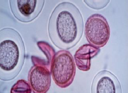 <p>Type of pollen? </p>