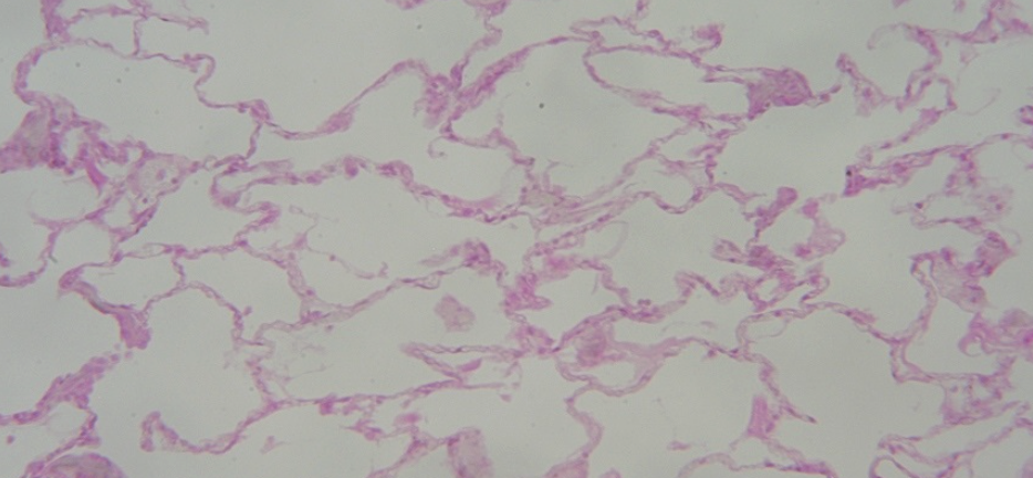 <p>Alveolus </p>
