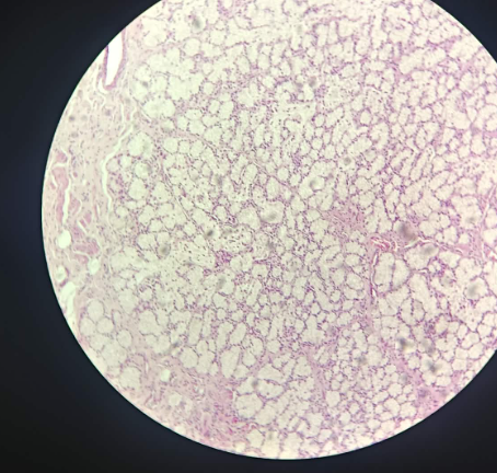 <p>Glandula Sublingualis - HE (29)</p><ul><li><p>located underneath the spine</p></li><li><p>more light structures</p></li><li><p>mucosa tsinin are dominating than serosa tsinin</p></li><li><p>also mixed atsinin (mucoctyes dominates the serocytes)</p></li></ul><p></p>