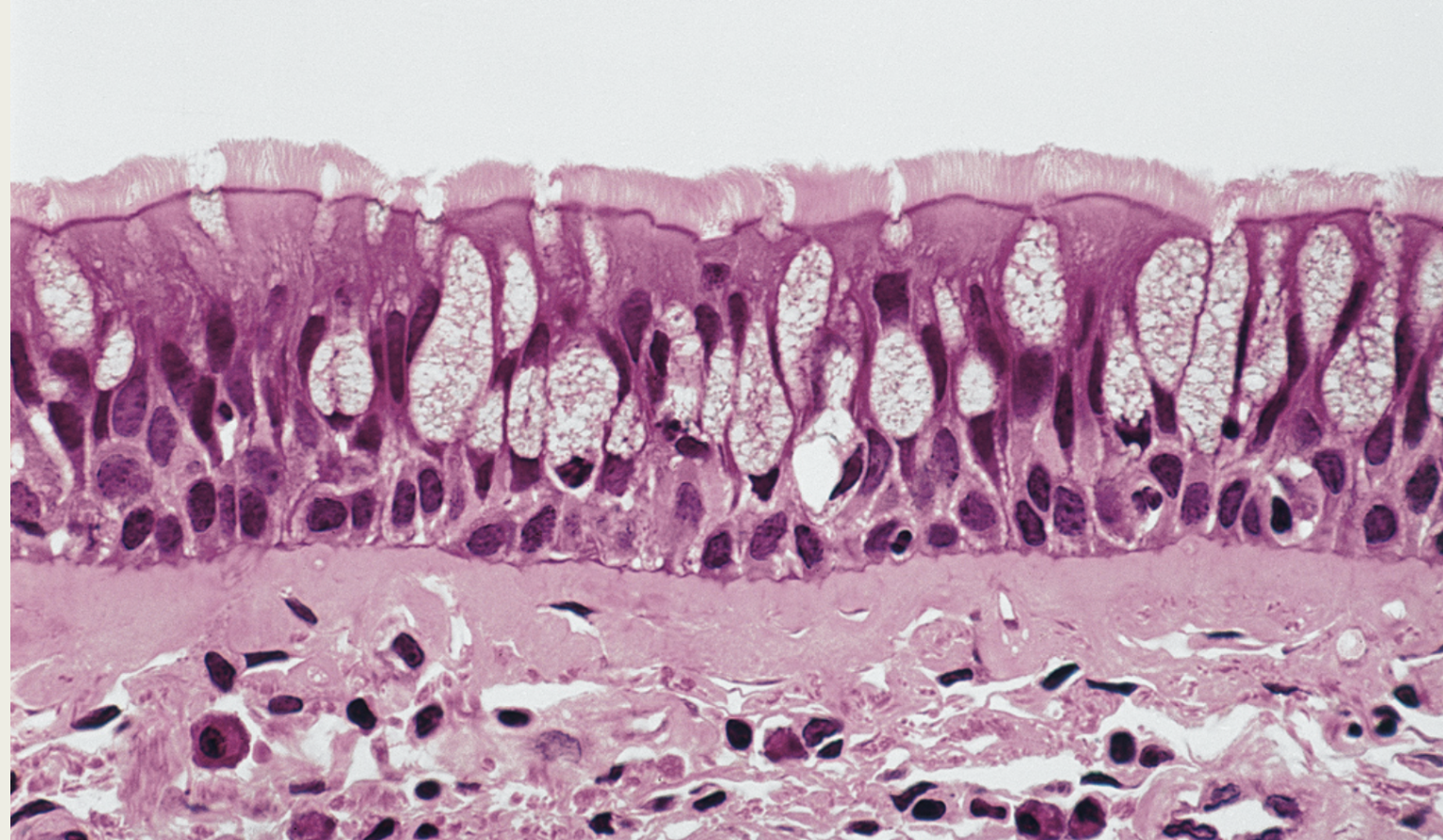 <p>Respiratory</p><p>Epithelium</p><p>■ Pseudostratified</p><p>Ciliated Columnar</p><p>– Lines most of the</p><p>XX XX </p><p>– Movement of</p><p>XX and XX</p><p>or microorganisms</p><p></p>