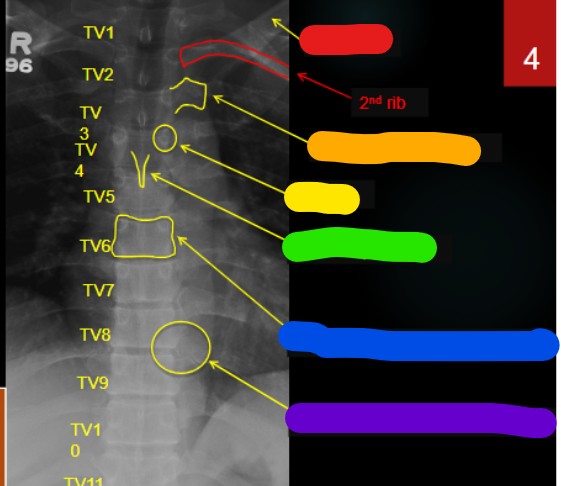 <p>What is red pointing to </p>