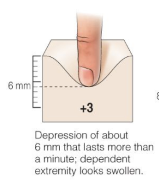 <p>6 mm</p><p>Depressionthat lasts more than a minute</p>