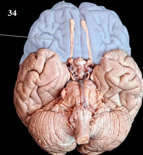 <p>What Lobe is This?</p>