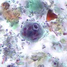 <p>Many small chromatid bodies with angular/pointed ends</p>
