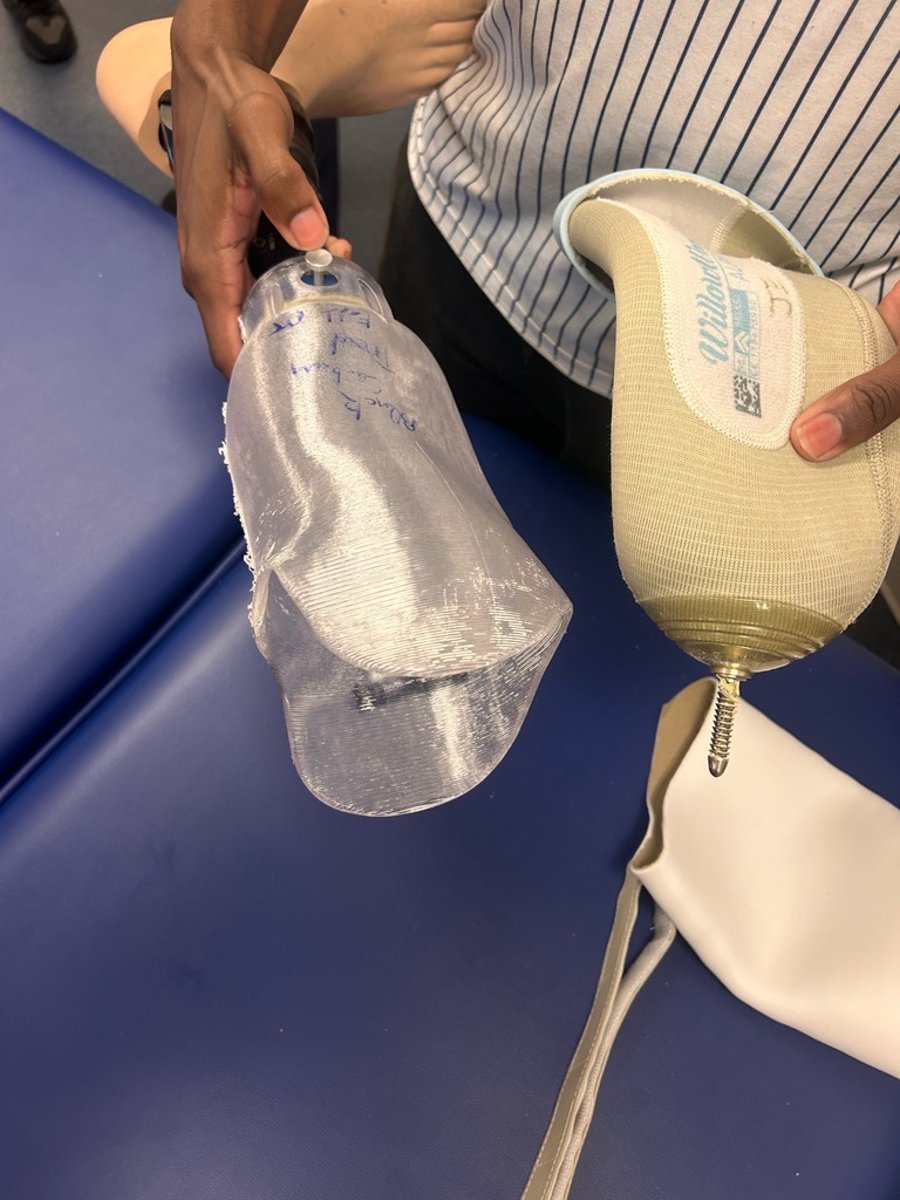 <p>TF or TT</p><p>**release button on outside of socket releases it</p><p>**Provides secure attachment /easy to use</p><p>** stable limb volume</p>