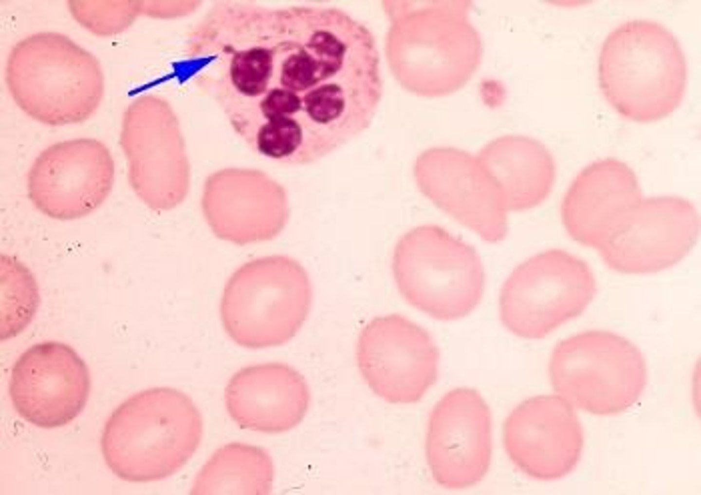 <p>A dense body formed from a deactivated X chromosome. Females therefore have a 50% chance of producing a gene if heterozygous for it</p>