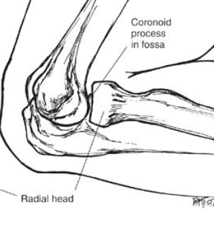 <p>radial + coronoid fossae of the distal humerus </p>