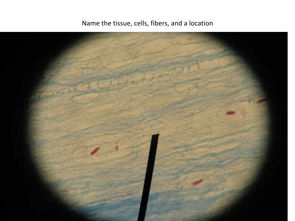 <p>Location of this tissue?</p>