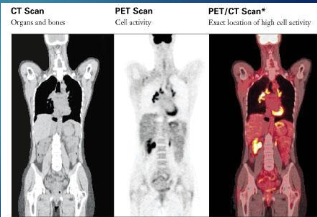 <p>PET, SPECT, PET/CT</p>