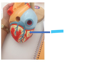 <p>What is the blue arrow?</p>