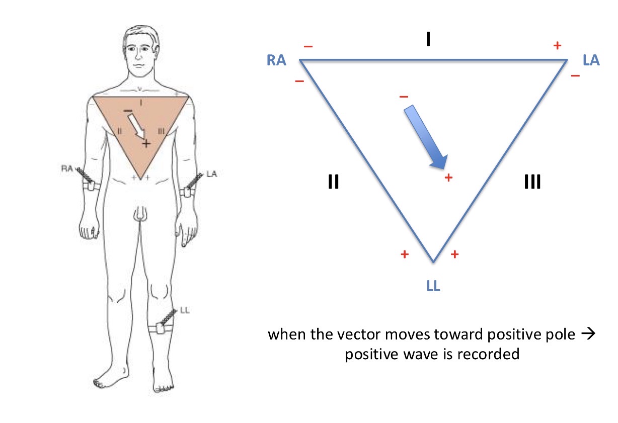 <p>The Einthoven triangle - right arm, left arm, lower limb</p><p>You measure the potential differences on each part of the triangle and this measures the change parallel with that side. So when the vector moves towards a positive pole, a positive wave is recorded</p><p></p><p>This is the highest wave on the ECG - the R wave</p>