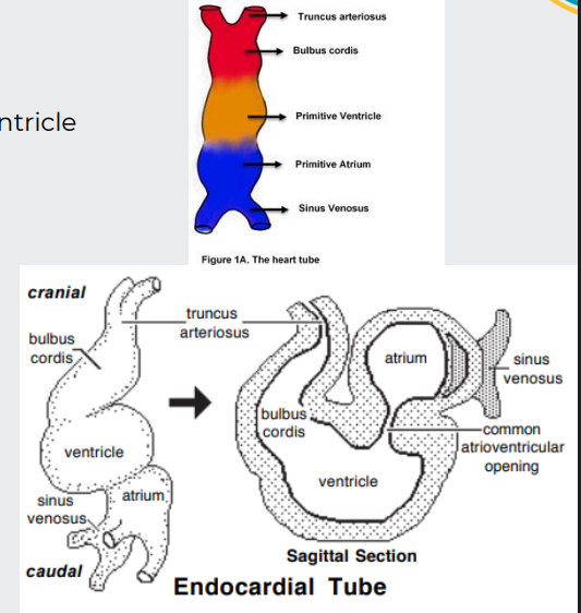 <p><strong>Endocardial tube lengthens and loops on itself</strong></p><p>This puts the<span style="color: purple;"> bulbus cordis (right ventricle</span>) beside the ventricle (left ventricle) and the atrium dorsal to the ventricle</p><p></p><p><strong>Venous return is s</strong><span style="color: purple;"><strong>hifted to the right</strong></span></p><p>The larger right <span style="color: purple;">sinus venosus becomes the right atrium </span>(embryonic atrium becomes auricles)</p><p></p><p>The smaller left sinus venosus joins the future right atrium as the coronary sinus venosus</p>